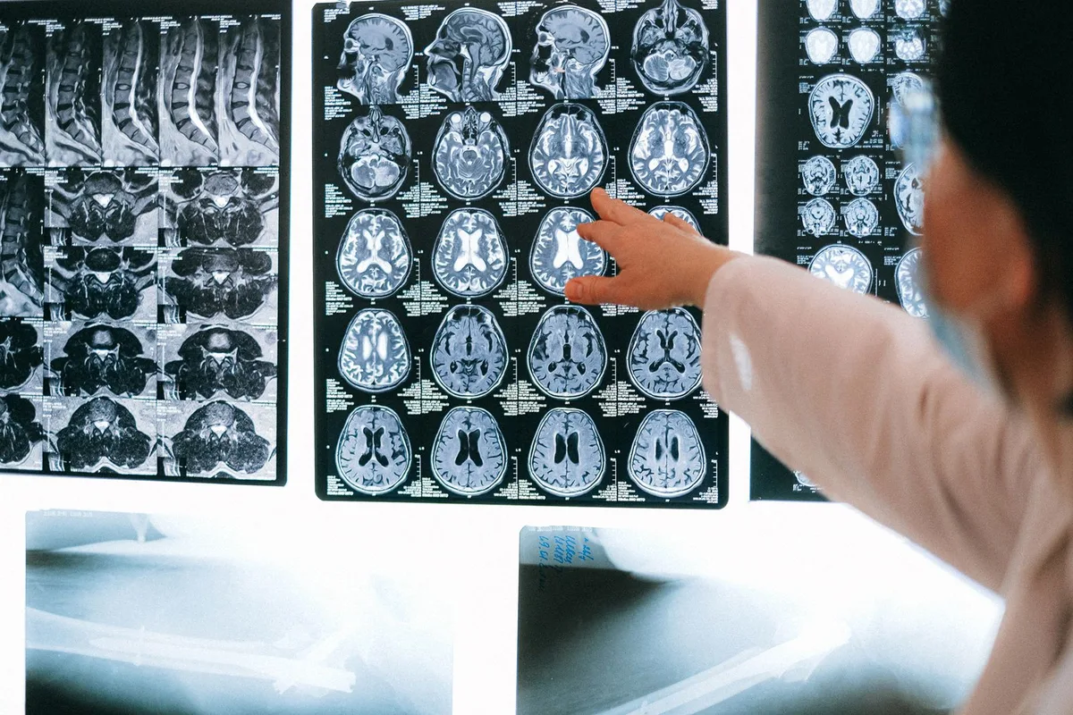 Radiologist reviewing MRI images on a lightbox